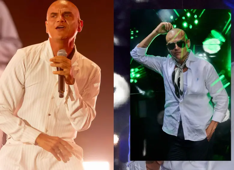 Silvestre Dangond revela la verdadera razón detrás de su radical cambio de look y calvicie