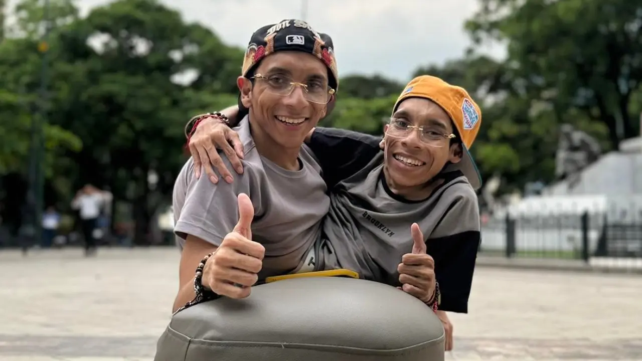 El impresionante legado de los hermanos Cevallos, los icónicos siameses de Ecuador